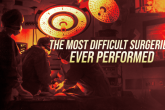Operating room scene with surgeons at work under bright circular lights and bold overlay text about difficult surgeries to be performeded (banner reads 'The Most Difficult Surgeries Ever Performed').