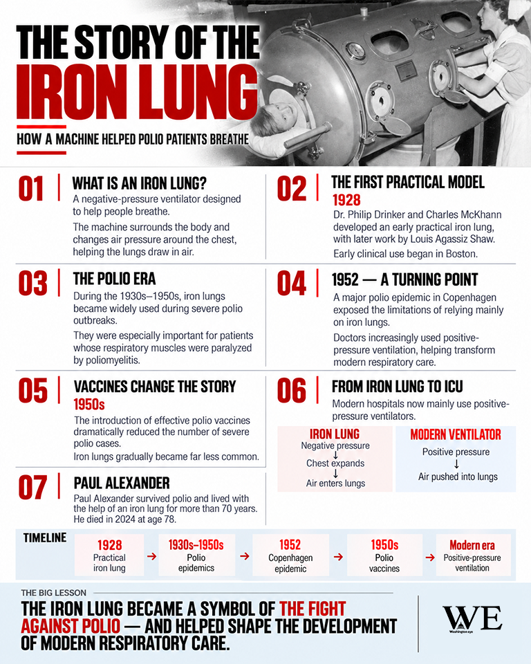 story of the iron lung 1 - washington eye